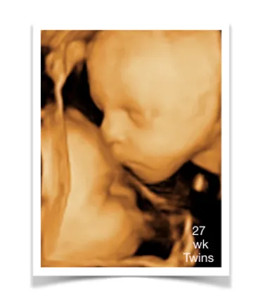 Digibaby Ultrasound images
