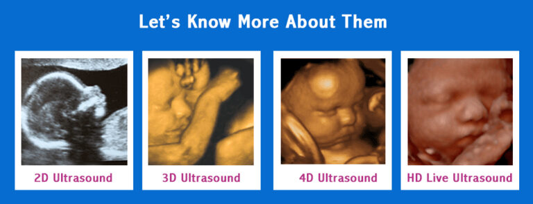 Pregnancy Ultrasound